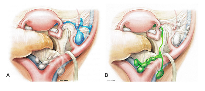 Fig3AB-SLN-Mapping-001.jpg
